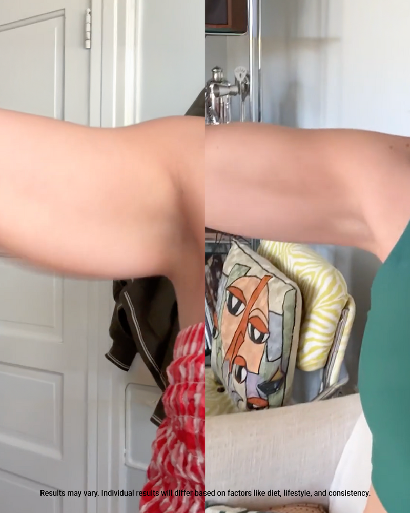 Split-screen before-and-after of a woman’s upper arm showing a firmer, smoother tone in a home setting
